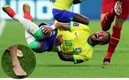 Así quedó el tobillo de Neymar tras lesionarse ante Serbia. Fotos: (Reuters)