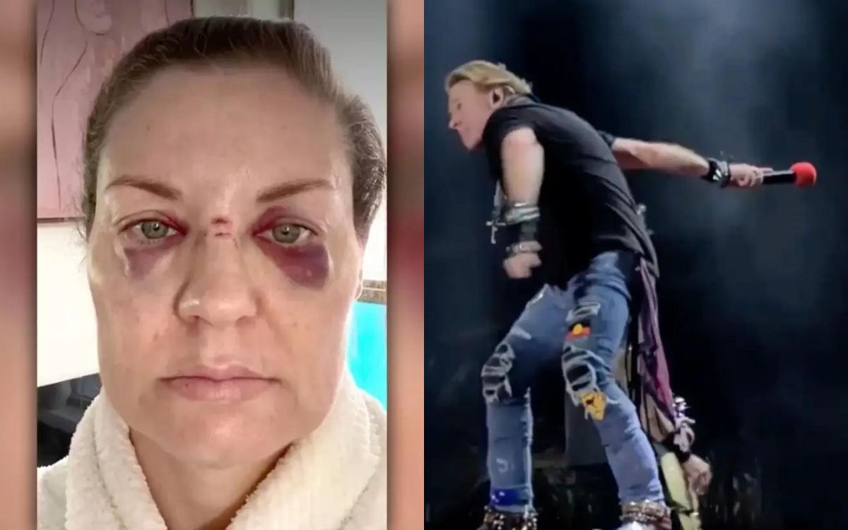 Las heridas que sufrió Howe tras recibir el golpe. (Tiktok y captura)