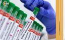 La Secretaría de Salud emitió un Aviso Epidemiológico por el incremento de los casos (Reuters)