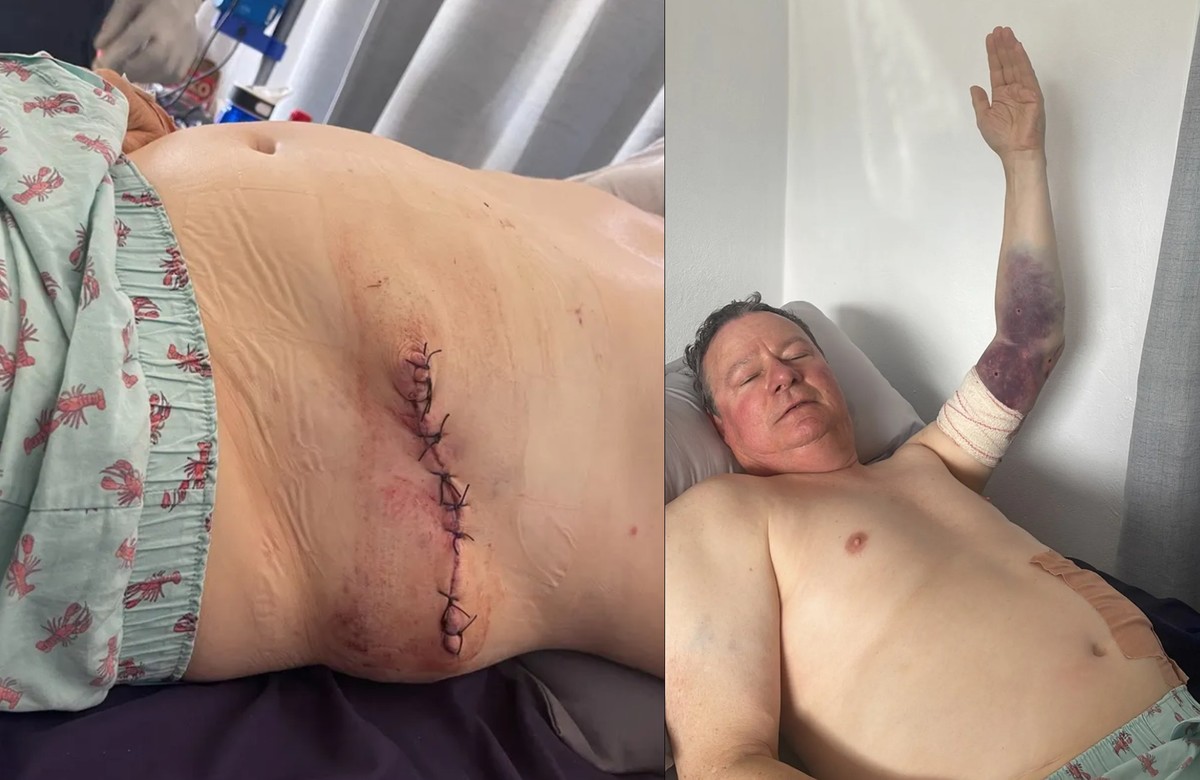 Roland Cherry sufrió heridas en su torso, ambas piernas y brazo izquierdo. Foto: TMZ