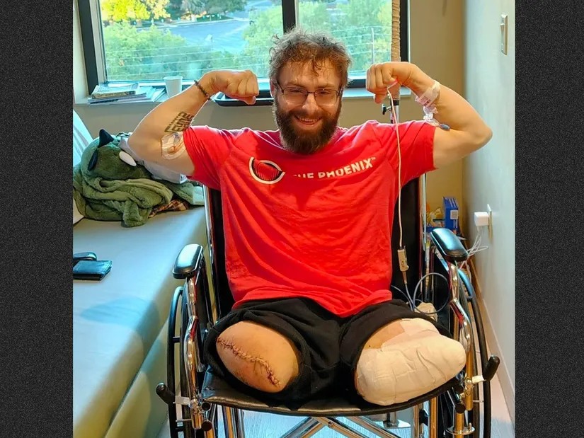 John sufrió amputación de ambas piernas, y se creyó que no sobreviviría al incidente. Foto: Denver Post