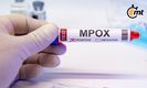 Estos son los casos confirmados de Mpox en México AL MOMENTO