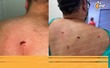 Aficionado de Atlas herido por una navaja (Foto: Cortesía)