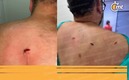 Aficionado de Atlas herido por una navaja (Foto: Cortesía)