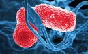 La bacteria Klebsiella-Oxytoca ya ha cobrado vidas en México | Foto: CNN |