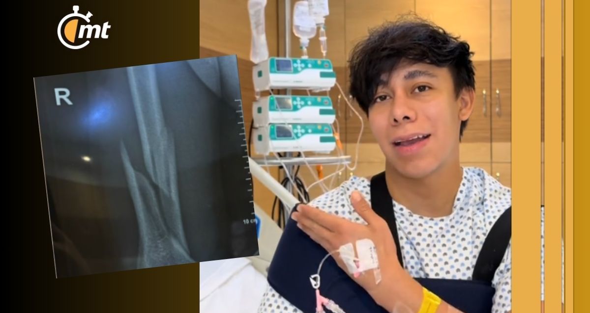 ‘Sonrixs’ revela que podría perder su brazo por jugar a las fuercitas| Foto:  sonrixs_