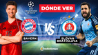 El Bayern Munich y el Bratislava se enfrentan este miércoles por la Champions League.