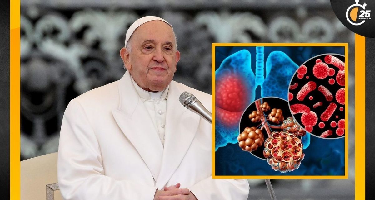 Conoce la neumonía bilateral, enfermedad que padece el papa Francisco. Foto: Especial