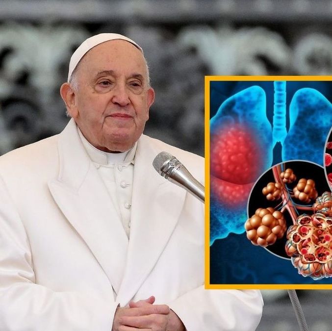 Conoce la neumonía bilateral, enfermedad que padece el papa Francisco. Foto: Especial