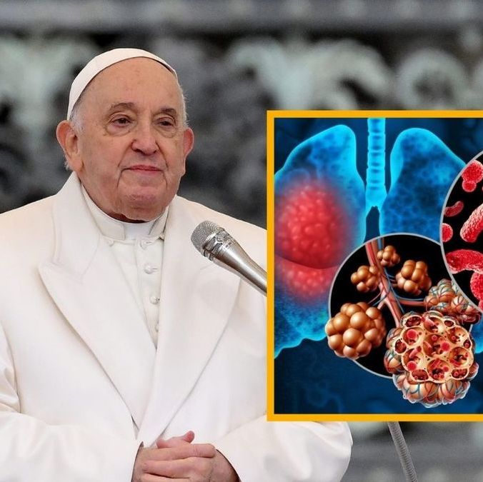 Conoce la neumonía bilateral, enfermedad que padece el papa Francisco. Foto: Especial