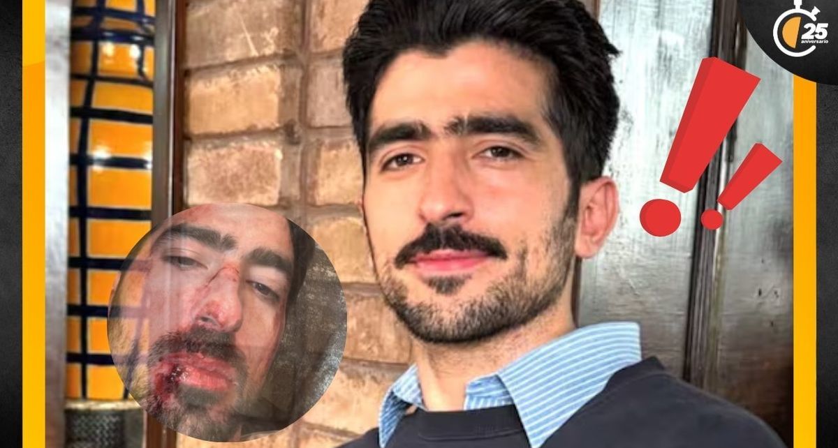 El influencer Jezzini publica fuerte imagen que preocupa a sus seguidores