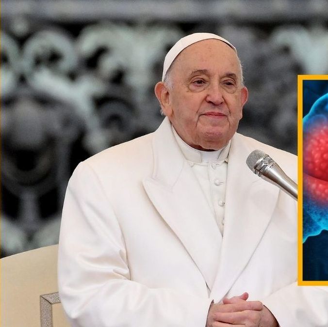 Conoce la neumonía bilateral, enfermedad que padece el papa Francisco. Foto: Especial