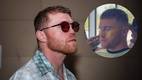 Canelo Álvarez recibe un tratamiento facial con oro (Ig canelo)