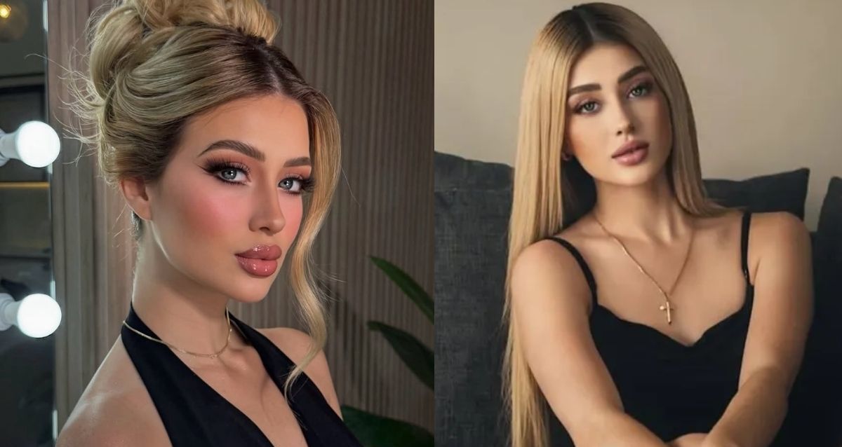 La influencer realizaba un live cuando fue atacada.