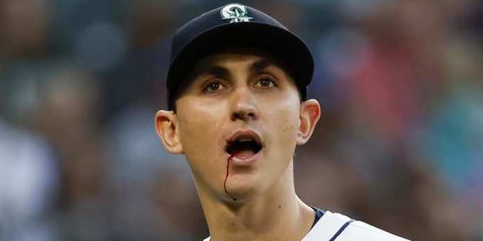 Así quedó la boca del pitcher de Seattle Mariners tras el hit de Ramón Urías. Foto: X