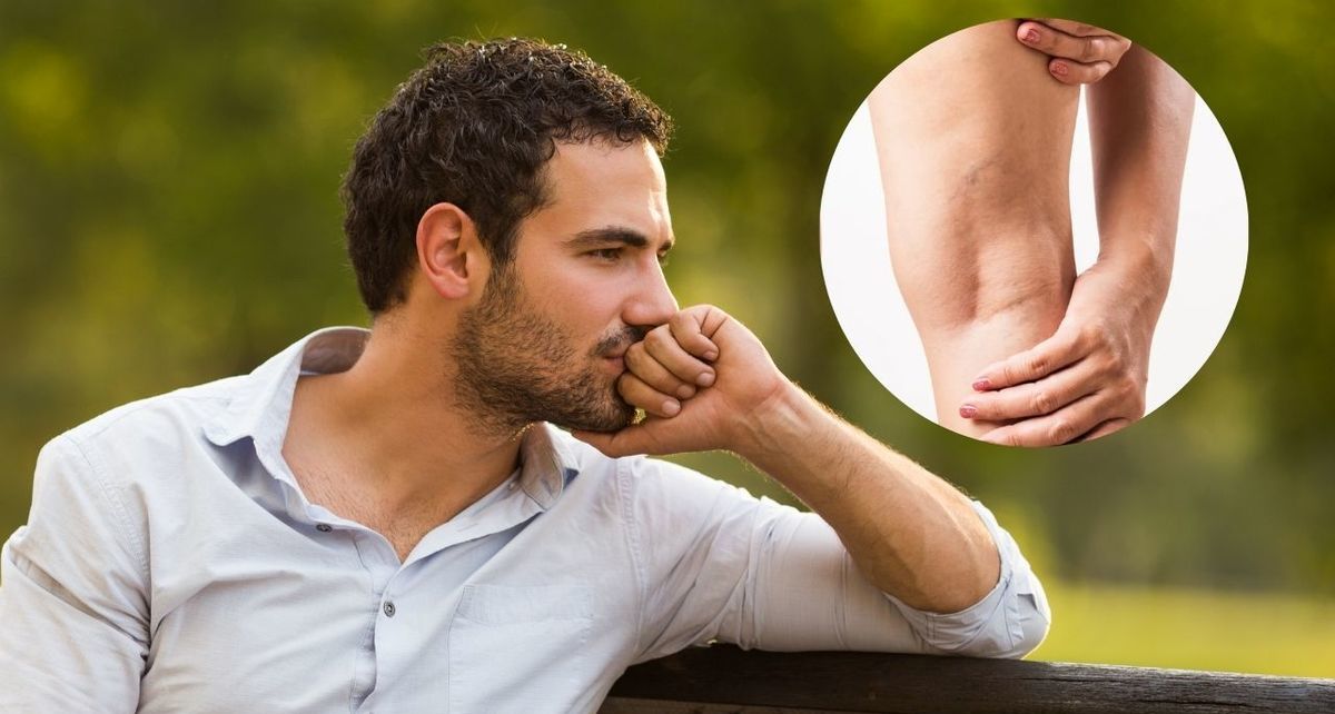 El 70% de los mexicanos padecen insuficiencia venosa crónica, desconociendo la mayoría de ellos qué es dicho trastorno. (FOTO): Especial.