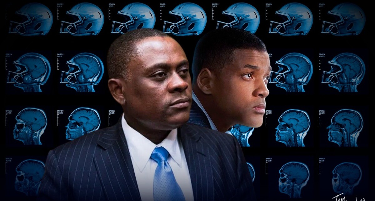 Concussion, la película que revivió la importancia médica (Tom Mendoza)