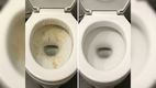 ¿Manchas en el inodoro? Así puedes quitar el sarro de tu taza de baño de manera efectiva. (FOTO): Especial.
