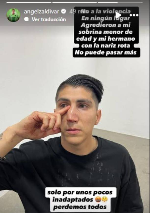 Hermano de Zaldívar tras las agresiones sufridas (@angelzaldivar)