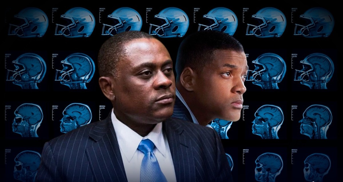 Concussion, la película que revivió la importancia médica (Tom Mendoza)