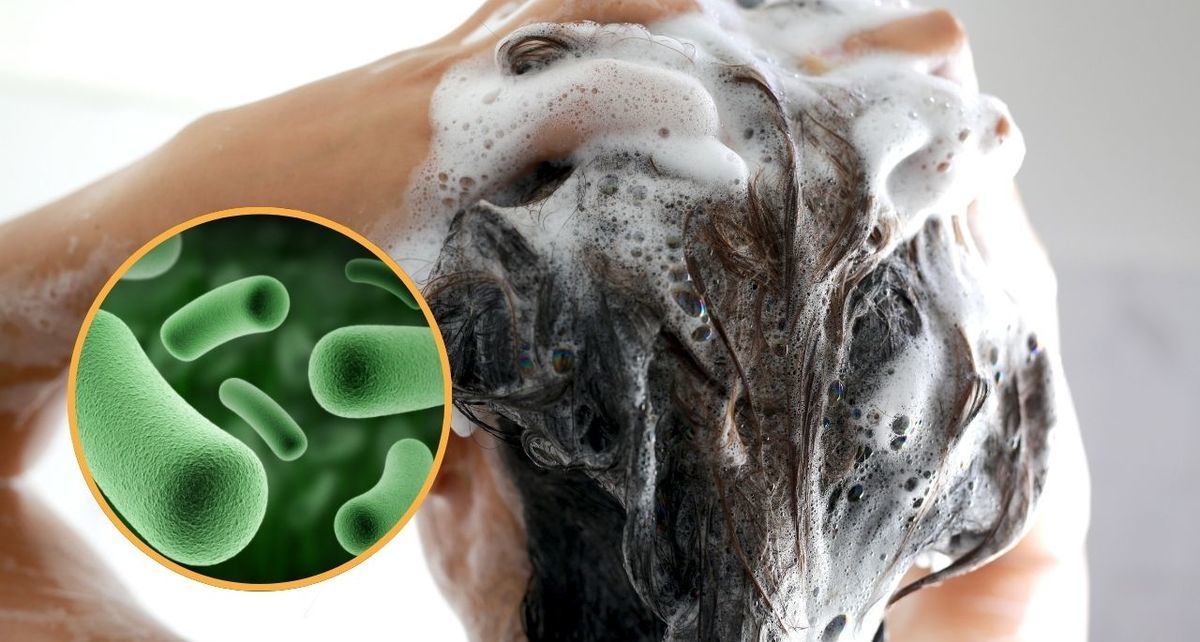 El Shampoo Totale de Henkel Capital puede causar severas infecciones en ojos, nariz y piel, acorde a Profeco. Foto: Especial
