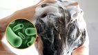 El Shampoo Totale de Henkel Capital puede causar severas infecciones en ojos, nariz y piel, acorde a Profeco. Foto: Especial