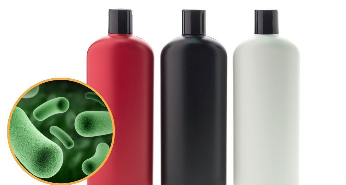 El Shampoo Totale de Henkel Capital puede causar severas infecciones en ojos, nariz y piel, acorde a Profeco. Foto: Especial