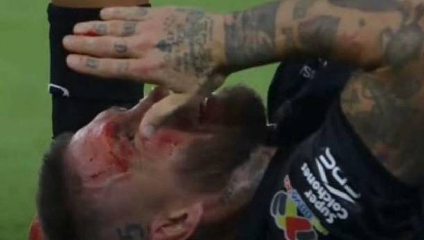 Ramos terminó con sangre en el rostro / Captura de pantalla