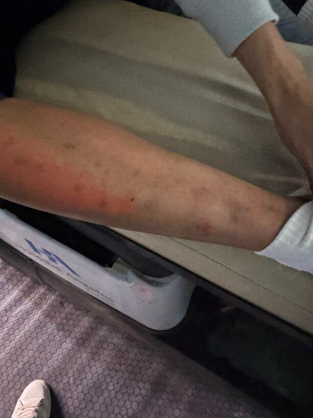 Así quedó la pierna de Kevin Mier (Captura)