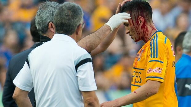 Torres Nilo era muy intenso para jugar. (Foto: Mexsport)