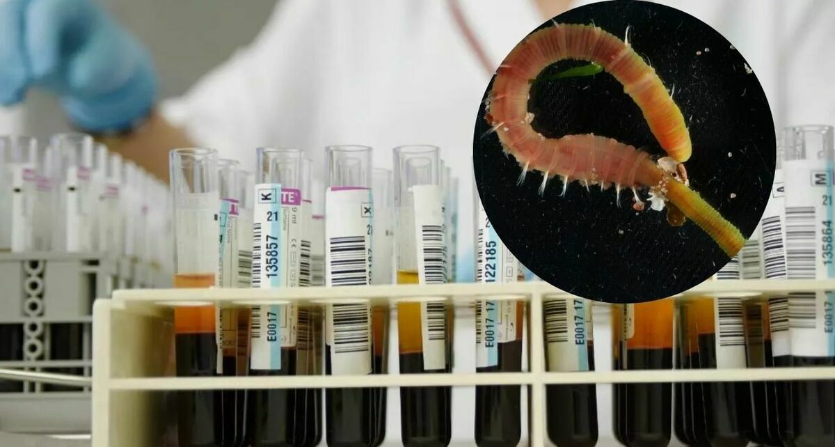 Se ha identificado como Lance A este nuevo dopaje. (Foto: EFE)