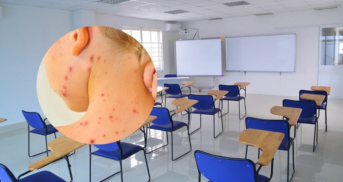 Suspenderán clases por casos de sarampión en estas escuelas de México