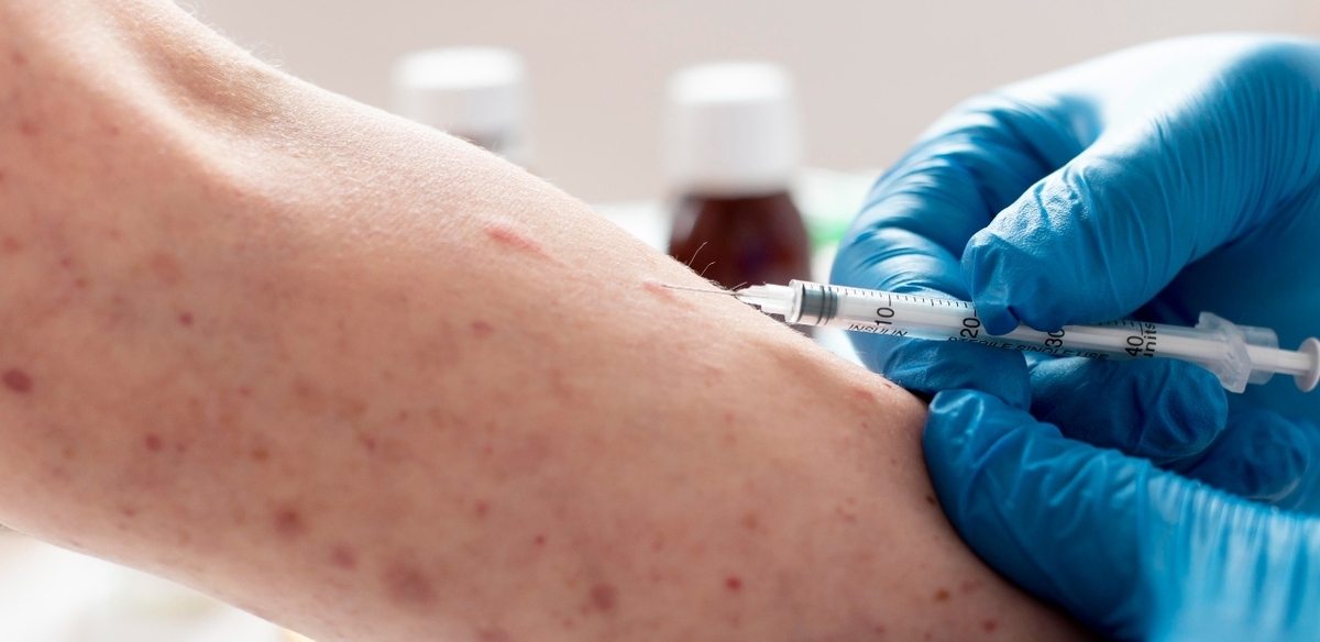 Conoce las ubicaciones donde te puedes vacunar gratis contra la sarampión en CDMX. Foto: Freepik