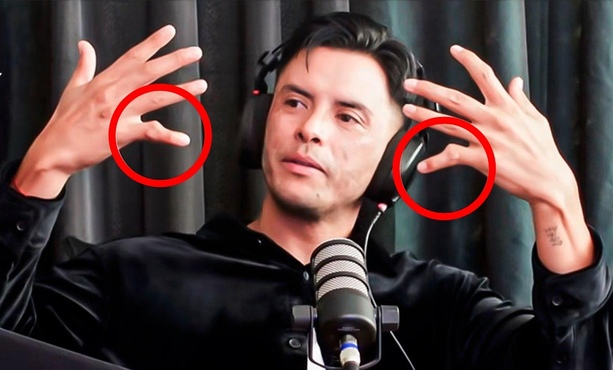 Así lucen las manos de Talavera (Captura @contraclickbros)