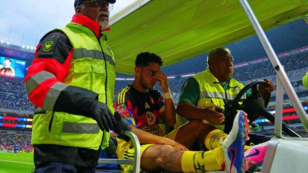 Sebastián Cáceres salió lesionado en encuentro ante Pumas / Imago7