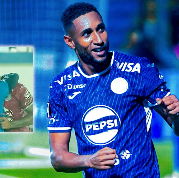Romario Da Silva  sufrió una fuerte lesión en el tobillo izquierdo. (Foto: @MOTAGUAcom)