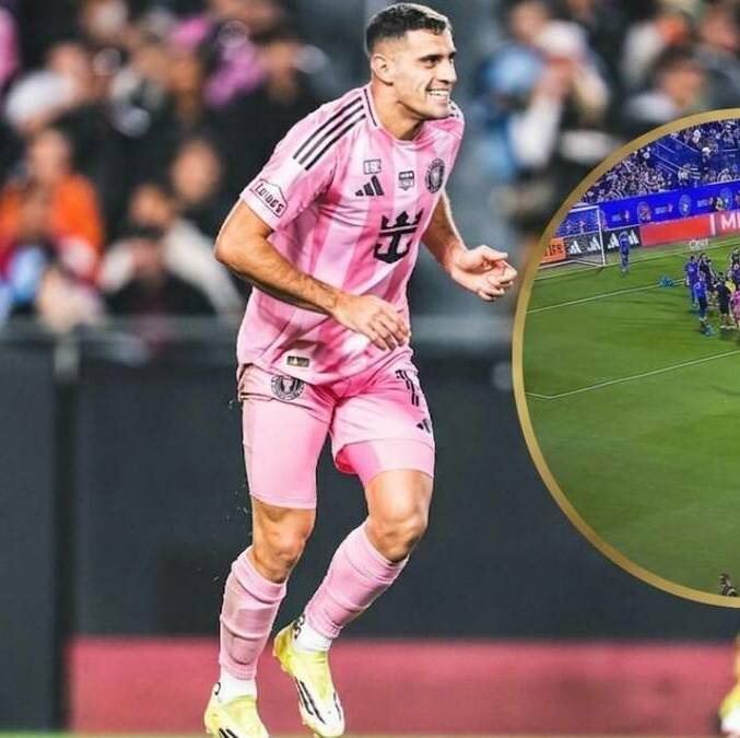 Berterame fue llevado a un hospital (@InterMiamiCF)