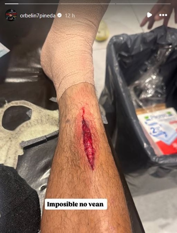 Así quedó la pierna de Orbelín Pineda (@orbelin7pineda)