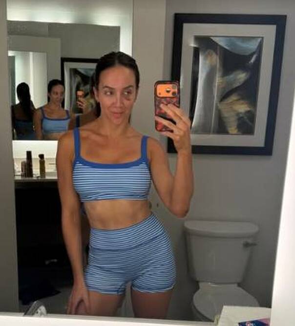 Chelsea Green compartió una imagen en sus historias de Instagram donde se aprecia la lesión en su ojo derecho. FOTO: @chelseaagreen