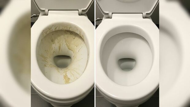 ¿Manchas en el inodoro? Así puedes quitar el sarro de tu taza de baño de manera efectiva. (FOTO): Especial.
