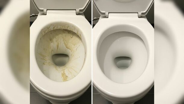 ¿Manchas en el inodoro? Así puedes quitar el sarro de tu taza de baño de manera efectiva. (FOTO): Especial.