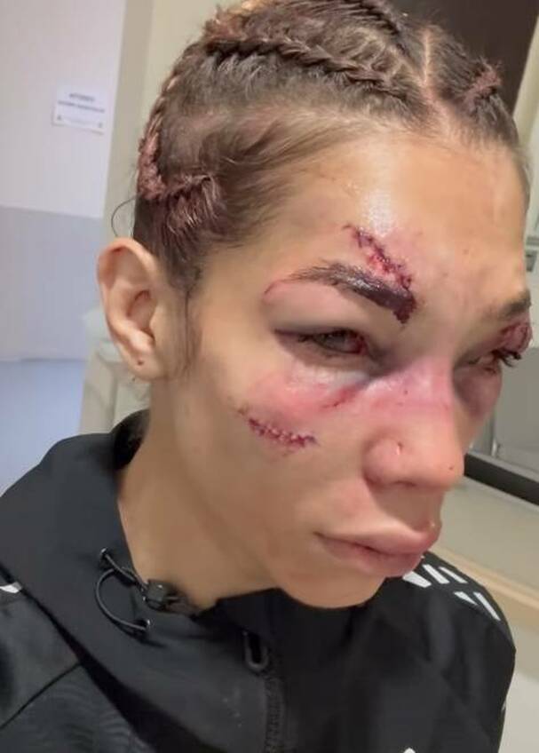 Así quedó el rostro de la peleadora argentina Sofia 'La Bruja' Montenegro. FOTO: @sofiimontenegromma